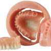 keymill denture base disc