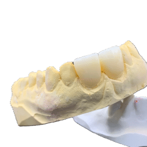 Katana YML Zirconia Crown