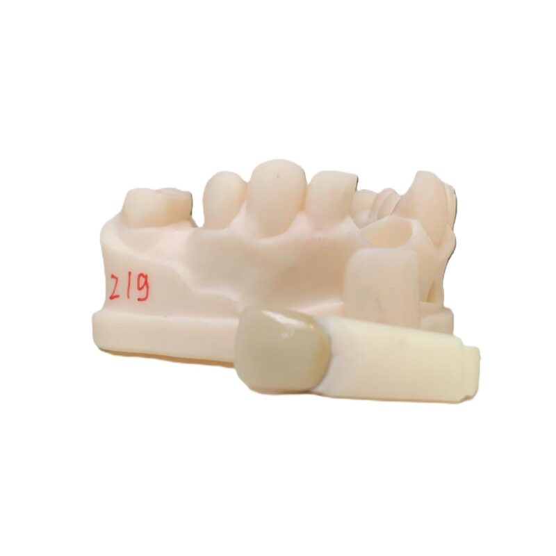 Porcelane Bonded Crown