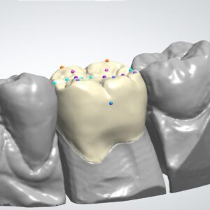 CAD anatomic crown
