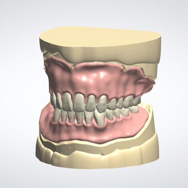 full full denture cad