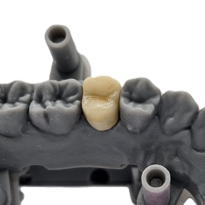 Dental lab zirconia Argenz ht