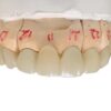 Dental lab zirconia argenz stml a2