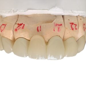 Dental lab zirconia argenz stml a2