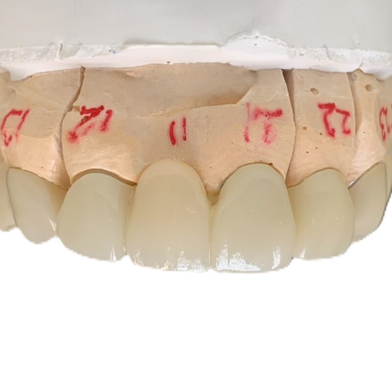 Dental lab zirconia argenz stml a2