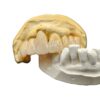 Dental Lab Zirconia Fitted Bridge