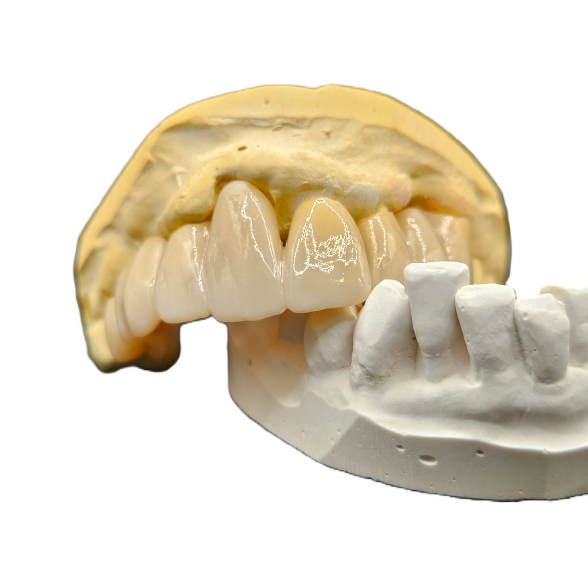 Dental Lab Zirconia Fitted Bridge