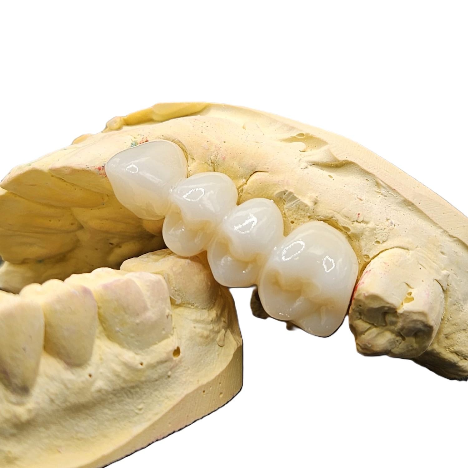 Dental Lab ArgenZ HTML Zirconia B1