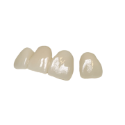 argen zirconia crown and bridge a2